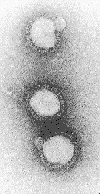 micrograph of influenza A